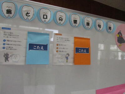 歯と口のクイズ掲示