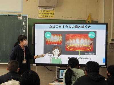６年生歯科保健指導１