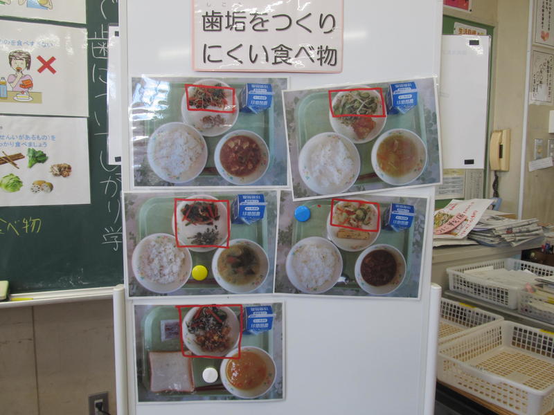 歯垢を作りにくい食材